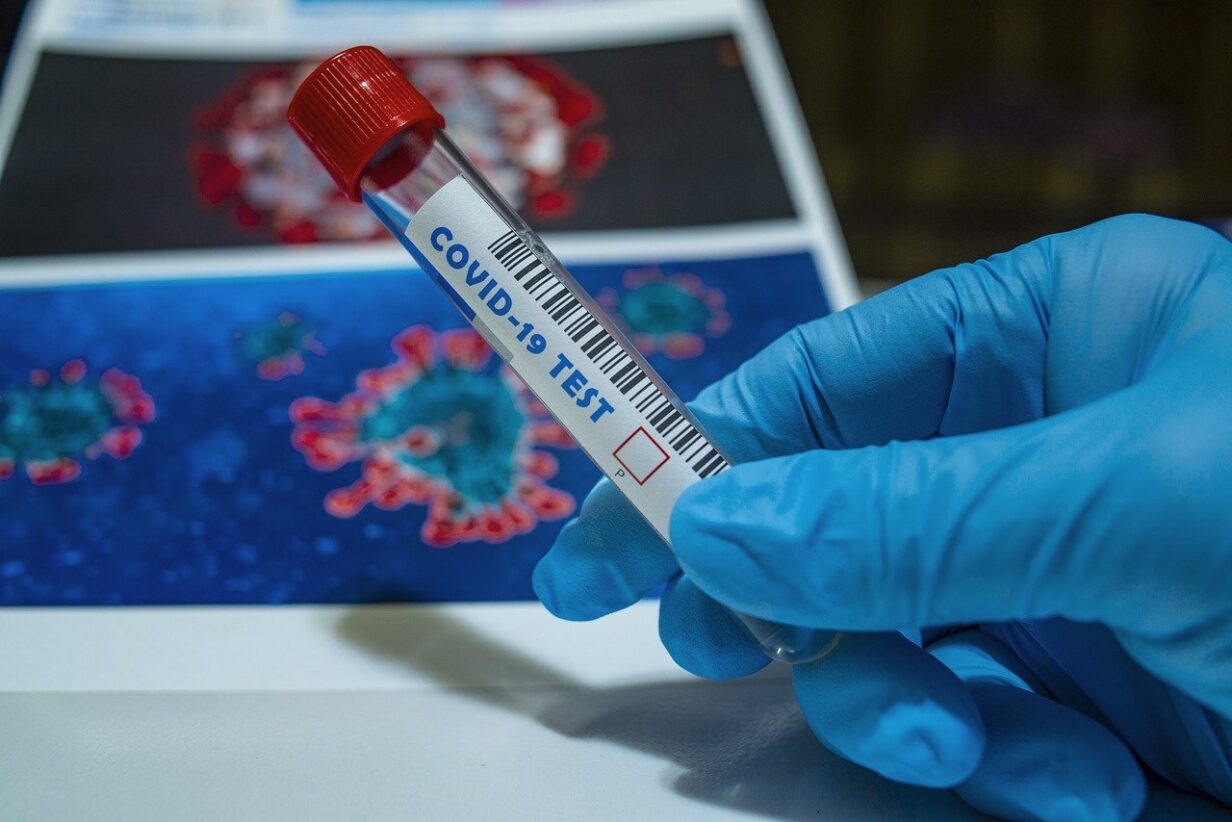 covid pcr test